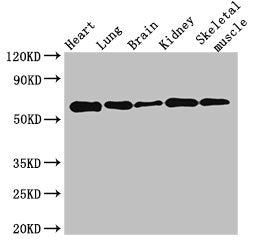 Western Blot | Positive WB detected in: Mouse heart tissue, Mouse lung tissue, Mouse brain tissue, Mouse kidney tissue, Mouse skeletal muscle tissue | All lanes: KPNA4 antibody at 3.5μg/ml | Secondary | Goat polyclonal to rabbit IgG at 1/50000 dilution | Predicted band size: 58 kDa | Observed band size: 58 kDa