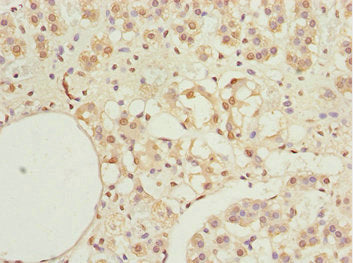 Immunohistochemistry of paraffin-embedded human adrenal gland tissue using KPNA6 Antibody at dilution of 1:100