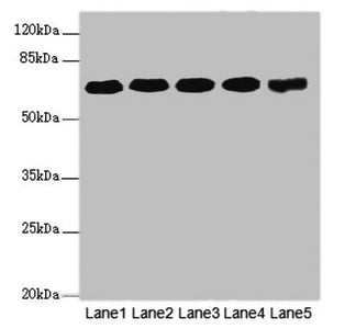 Western blot | All lanes: KPNA6 antibody at 4.25μg/ml | Lane 1: PC-3 whole cell lysate | Lane 2: Hela whole cell lysate | Lane 3: U251 whole cell lysate | Lane 4: 293T whole cell lysate | Lane 5: Mouse brain tissue | Secondary | Goat polyclonal to rabbit IgG at 1/10000 dilution | Predicted band size: 60 kDa | Observed band size: 60 kDa