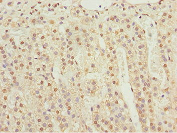 Immunohistochemistry of paraffin-embedded human adrenal gland tissue using KPNA6 Antibody at dilution of 1:100Rabbit anti-Human KPNA6 Polyclonal Antibody