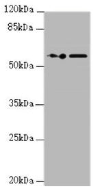Western blot  | All lanes: KPNA6 antibody at 0.95µg/ml  | Lane 1: PC-3 whole cell lysate  | Lane 2: Hela whole cell lysate  | Secondary  | Goat polyclonal to rabbit IgG at 1/10000 dilution  | Predicted band size: 60 kDa  | Observed band size: 60 kDa