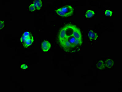 Immunofluorescence staining of MCF-7 cells with KRT1 Antibody at 1:133, counter-stained with DAPI. The cells were fixed in 4% formaldehyde, permeabilized using 0.2% Triton X-100 and blocked in 10% normal Goat Serum. The cells were then incubated with the antibody overnight at 4°C. The secondary antibody was Alexa Fluor 488-congugated AffiniPure Goat Anti-Rabbit IgG(H+L).