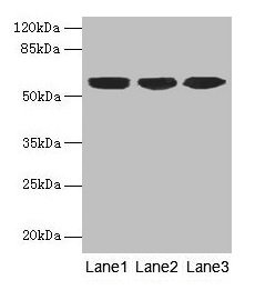 Western blot  | All lanes: KRT10 antibody at 6µg/ml  | Lane 1: A431 whole cell lysate  | Lane 2: HepG2 whole cell lysate  | Lane 3: MCF-7 whole cell lysate  | Secondary  | Goat polyclonal to rabbit IgG at 1/10000 dilution  | Predicted band size: 59 kDa  | Observed band size: 59 kDa