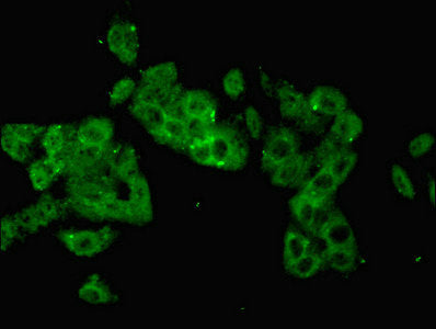 Immunofluorescent analysis of HepG2 cells using KRT14 Antibody at dilution of 1:100 and Alexa Fluor 488-congugated AffiniPure Goat Anti-Rabbit IgG(H+L)