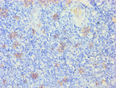Immunohistochemistry of paraffin-embedded human tonsil tissue using the antibody at dilution of 1:100
