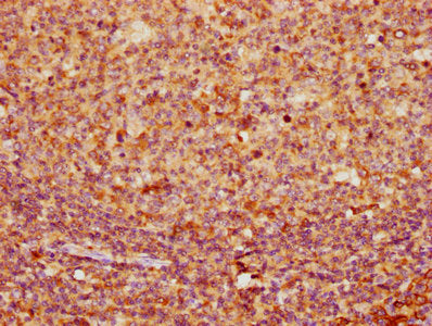 IHC image of KRT16 Antibody diluted at 1:400 and staining in paraffin-embedded human tonsil tissue performed on a Leica BondTM system. After dewaxing and hydration, antigen retrieval was mediated by high pressure in a citrate buffer (pH 6.0). Section was blocked with 10% normal goat serum 30min at RT. Then primary antibody (1% BSA) was incubated at 4°C overnight. The primary is detected by a biotinylated secondary antibody and visualized using an HRP conjugated SP system.