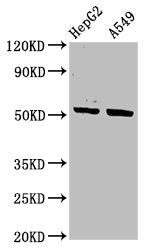 Western Blot | Positive WB detected in: HepG2 whole cell lysate, A549 whole cell lysate | All lanes: KRT16 antibody at 3.4μg/ml | Secondary | Goat polyclonal to rabbit IgG at 1/50000 dilution | Predicted band size: 52 kDa | Observed band size: 52 kDa