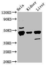 Western Blot  | Positive WB detected in: Hela whole cell lysate, Mouse kidney tissue, Mouse liver tissue  | All lanes: Krt18 antibody at 5.5µg/ml  | Secondary  | Goat polyclonal to rabbit IgG at 1/50000 dilution  | Predicted band size: 48 kDa  | Observed band size: 48 kDaRabbit anti-Mus musculus (Mouse) Krt18 Polyclonal Antibody