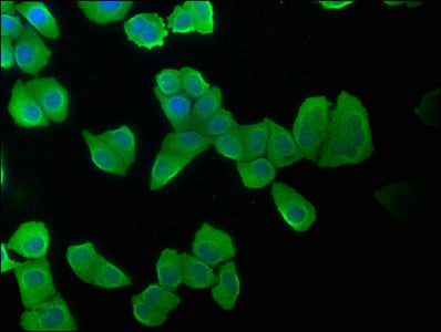 Immunofluorescence staining of Hela cells with KRT20 Antibody at 1:100, counter-stained with DAPI. The cells were fixed in 4% formaldehyde, permeabilized using 0.2% Triton X-100 and blocked in 10% normal Goat Serum. The cells were then incubated with the antibody overnight at 4°C. The secondary antibody was Alexa Fluor 488-congugated AffiniPure Goat Anti-Rabbit IgG(H+L).