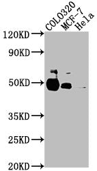 Western Blot | Positive WB detected in: COLO320 whole cell lysate, MCF-7 whole cell lysate, Hela whole cell lysate | All lanes: KRT20 antibody at 1:2000 | Secondary | Goat polyclonal to rabbit IgG at 1/50000 dilution | Predicted band size: 49 kDa | Observed band size: 49 kDa