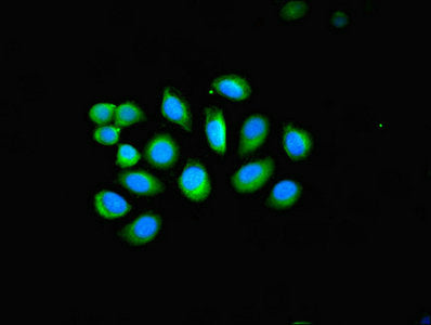 Immunofluorescent analysis of A549 cells using KRT4 Antibody at dilution of 1:100 and Alexa Fluor 488-congugated AffiniPure Goat Anti-Rabbit IgG(H+L)