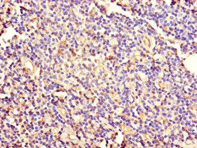 Immunohistochemistry of paraffin-embedded human tonsil tissue using KRT4 Antibody at dilution of 1:100