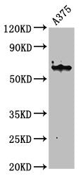 Western Blot  | Positive WB detected in: A375 whole cell lysate  | All lanes: KRT6A antibody at 4.6µg/ml  | Secondary  | Goat polyclonal to rabbit IgG at 1/50000 dilution  | Predicted band size: 61 kDa  | Observed band size: 61 kDa