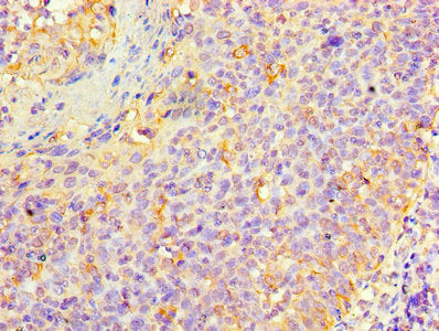 Immunohistochemistry of paraffin-embedded human tonsil tissue using KRT6A Antibody at dilution of 1:100
