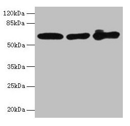 Western blot  | All lanes: KRT6A antibody at 4µg/ml  | Lane 1: A431 whole cell lysate  | Lane 2: K562 whole cell lysate  | Lane 3: MCF-7 whole cell lysate  | Secondary  | Goat polyclonal to rabbit IgG at 1/10000 dilution  | Predicted band size: 61 kDa  | Observed band size: 61 kDa