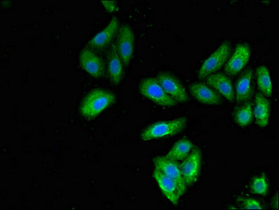 Immunofluorescent analysis of HepG2 cells using KRT7 Antibody at dilution of 1:100 and Alexa Fluor 488-congugated AffiniPure Goat Anti-Rabbit IgG(H+L)