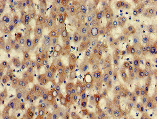 Immunohistochemistry of paraffin-embedded human liver tissue using the antibody at dilution of 1:100