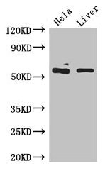 Western Blot  | Positive WB detected in: Hela whole cell lysate, Mouse liver tissue  | All lanes: KRT81 antibody at 5µg/ml  | Secondary  | Goat polyclonal to rabbit IgG at 1/50000 dilution  | Predicted band size: 55 kDa  | Observed band size: 55 kDa