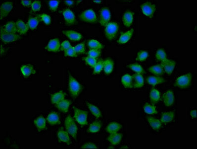 Immunofluorescence staining of Hela cells with KY Antibody at 1:133, counter-stained with DAPI. The cells were fixed in 4% formaldehyde, permeabilized using 0.2% Triton X-100 and blocked in 10% normal Goat Serum. The cells were then incubated with the antibody overnight at 4°C. The secondary antibody was Alexa Fluor 488-congugated AffiniPure Goat Anti-Rabbit IgG(H+L).