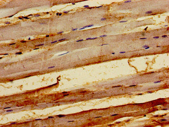 Immunohistochemistry of paraffin-embedded human skeletal muscle tissue using KY Antibody at dilution of 1:100