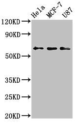 Western Blot  | Positive WB detected in: Hela whole cell lysate, MCF-7 whole cell lysate, U87 whole cell lysate  | All lanes: KY antibody at 3.2µg/ml  | Secondary  | Goat polyclonal to rabbit IgG at 1/50000 dilution  | Predicted band size: 64, 42, 73, 76 kDa  | Observed band size: 64 kDa