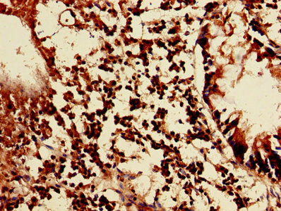 Immunohistochemistry of paraffin-embedded human appendix tissue using LAIR1 Antibody at dilution of 1:100