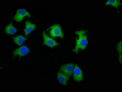 Immunofluorescence staining of A549 cells with LAMB4 Antibody at 1:50, counter-stained with DAPI. The cells were fixed in 4% formaldehyde, permeabilized using 0.2% Triton X-100 and blocked in 10% normal Goat Serum. The cells were then incubated with the antibody overnight at 4°C. The secondary antibody was Alexa Fluor 488-congugated AffiniPure Goat Anti-Rabbit IgG(H+L).