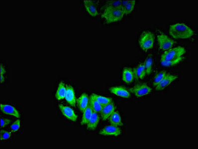 Immunofluorescent analysis of HepG2 cells using LAMP2 Antibody at dilution of 1:100 and Alexa Fluor 488-congugated AffiniPure Goat Anti-Rabbit IgG(H+L)
