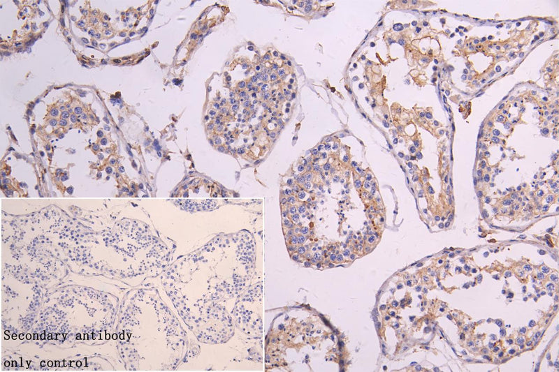 Immunohistochemistry of paraffin-embedded human brain tissue using LANCL1 Antibody at dilution of 1:100