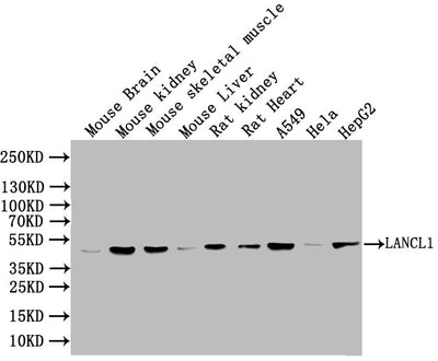 Western Blot | Positive WB detected in: Mouse heart tissue, Mouse liver tissue, Mouse stomach tissue | All lanes: LANCL1 antibody at 3μg/ml | Secondary | Goat polyclonal to rabbit IgG at 1/50000 dilution | Predicted band size: 46 kDa | Observed band size: 46 kDa