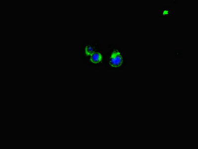 Immunofluorescent analysis of Hela cells using LATS1 Antibody at dilution of 1:100 and Alexa Fluor 488-congugated AffiniPure Goat Anti-Rabbit IgG(H+L)