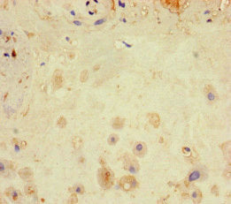Immunohistochemistry of paraffin-embedded human placenta tissue using the antibody at dilution of 1:100