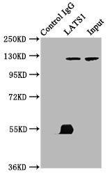 Immunoprecipitating LATS1 in K562 whole cell lysate   | Lane 1: Rabbit control IgG (1μg) instead of LATS1 Antibody in K562 whole cell lysate. For western blotting, a HRP-conjugated Protein G antibody was used as the secondary antibody (1/2000)  | Lane 2: LATS1 Antibody (6μg) + K562 whole cell lysate (500μg)  | Lane 3: K562 whole cell lysate (10μg)
