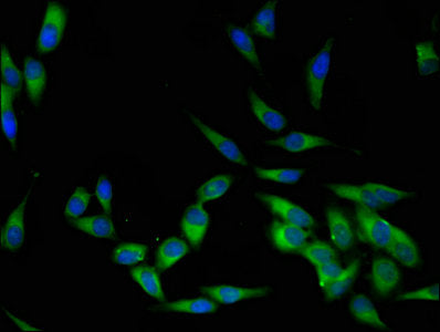 Immunofluorescent analysis of Hela cells using LCK Antibody at dilution of 1:100 and Alexa Fluor 488-congugated AffiniPure Goat Anti-Rabbit IgG(H+L)