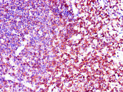 Immunohistochemistry of paraffin-embedded human tonsil tissue using the antibody at dilution of 1:100