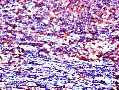 Immunohistochemistry of paraffin-embedded human lymph node tissue using LCK Antibody at dilution of 1:100