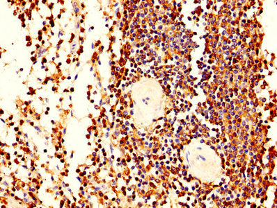 IHC image of LCP1 Antibody diluted at 1:400 and staining in paraffin-embedded human spleen tissue performed on a Leica BondTM system. After dewaxing and hydration, antigen retrieval was mediated by high pressure in a citrate buffer (pH 6.0). Section was blocked with 10% normal goat serum 30min at RT. Then primary antibody (1% BSA) was incubated at 4°C overnight. The primary is detected by a biotinylated secondary antibody and visualized using an HRP conjugated SP system.