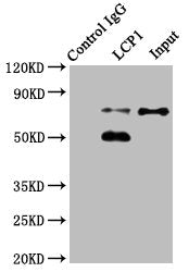 Immunoprecipitating LCP1 in Jurkat whole cell lysate  | Lane 1: Rabbit control IgG instead of LCP1 Antibody in Jurkat whole cell lysate. For western blotting, a HRP-conjugated Protein G antibody was used as the secondary antibody (1/2000)  | Lane 2: LCP1 Antibody (8µg) + Jurkat whole cell lysate (500µg)  | Lane 3: Jurkat whole cell lysate (20µg)