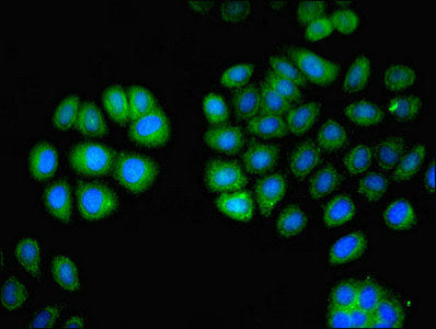Immunofluorescent analysis of A549 cells using LCP1 Antibody at dilution of 1:100 and Alexa Fluor 488-congugated AffiniPure Goat Anti-Rabbit IgG(H+L)