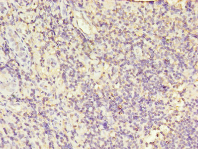 Immunohistochemistry of paraffin-embedded human tonsil tissue using LCP1 Antibody at dilution of 1:100