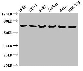 Western Blot  | Positive WB detected in: HL60 whole cell lysate, THP-1 whole cell lysate, K562 whole cell lysate, Jurkat whole cell lysate, Hela whole cell lysate, NIH/3T3 whole cell lysate  | All lanes: LCP1 antibody at 8µg/ml  | Secondary  | Goat polyclonal to rabbit IgG at 1/10000 dilution  | Predicted band size: 71, 22 kDa  | Observed band size: 71 kDa