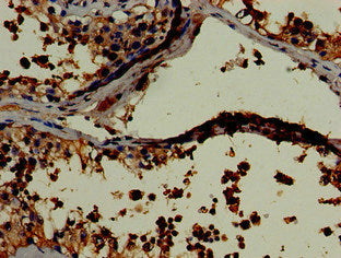 Immunohistochemistry of paraffin-embedded human testis tissue using LDHC Antibody at dilution of 1:100
