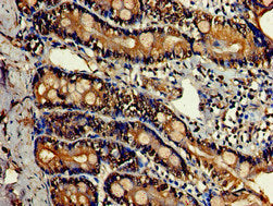 Immunohistochemistry of paraffin-embedded human small intestine tissue using LDHC Antibody at dilution of 1:100