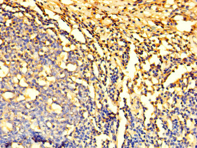 Immunohistochemistry of paraffin-embedded human tonsil tissue using DYNLL1 Antibody at dilution of 1:100Rabbit anti-Human DYNLL1 Polyclonal Antibody