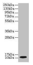 Western blot  | All lanes: DYNLL1 antibody at 2µg/ml + EC109 whole cell lysate  | Secondary  | Goat polyclonal to rabbit IgG at 1/15000 dilution  | Predicted band size: 11 kDa  | Observed band size: 11 kDaRabbit anti-Human DYNLL1 Polyclonal Antibody