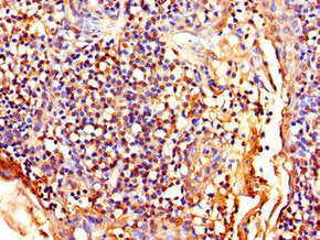 Immunohistochemistry of paraffin-embedded human tonsil tissue using LEF1 Antibody at dilution of 1:100Rabbit anti-Human LEF1 Polyclonal Antibody