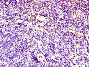 Immunohistochemistry of paraffin-embedded human lymph node tissue using LEF1 Antibody at dilution of 1:100Rabbit anti-Human LEF1 Polyclonal Antibody
