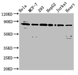Western Blot  | Positive WB detected in: Hela whole cell lysate, MCF-7 whole cell lysate, 293 whole cell lysate, HepG2 whole cell lysate, Jurkat whole cell lysate, Mouse heart tissue  | All lanes: LETM1 antibody at 6.5µg/ml  | Secondary  | Goat polyclonal to rabbit IgG at 1/50000 dilution  | Predicted band size: 84, 30, 34 kDa  | Observed band size: 84 kDa