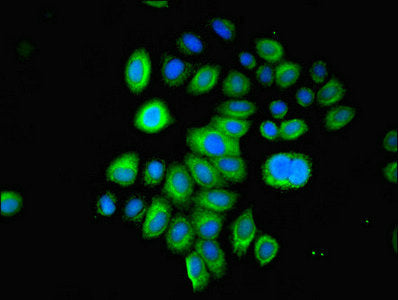 Immunofluorescent analysis of A549 cells using LGALS1 Antibody at dilution of 1:100 and Alexa Fluor 488-congugated AffiniPure Goat Anti-Rabbit IgG(H+L)