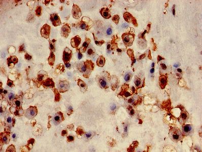 Immunohistochemistry of paraffin-embedded human placenta tissue using LGALS3 Antibody at dilution of 1:100